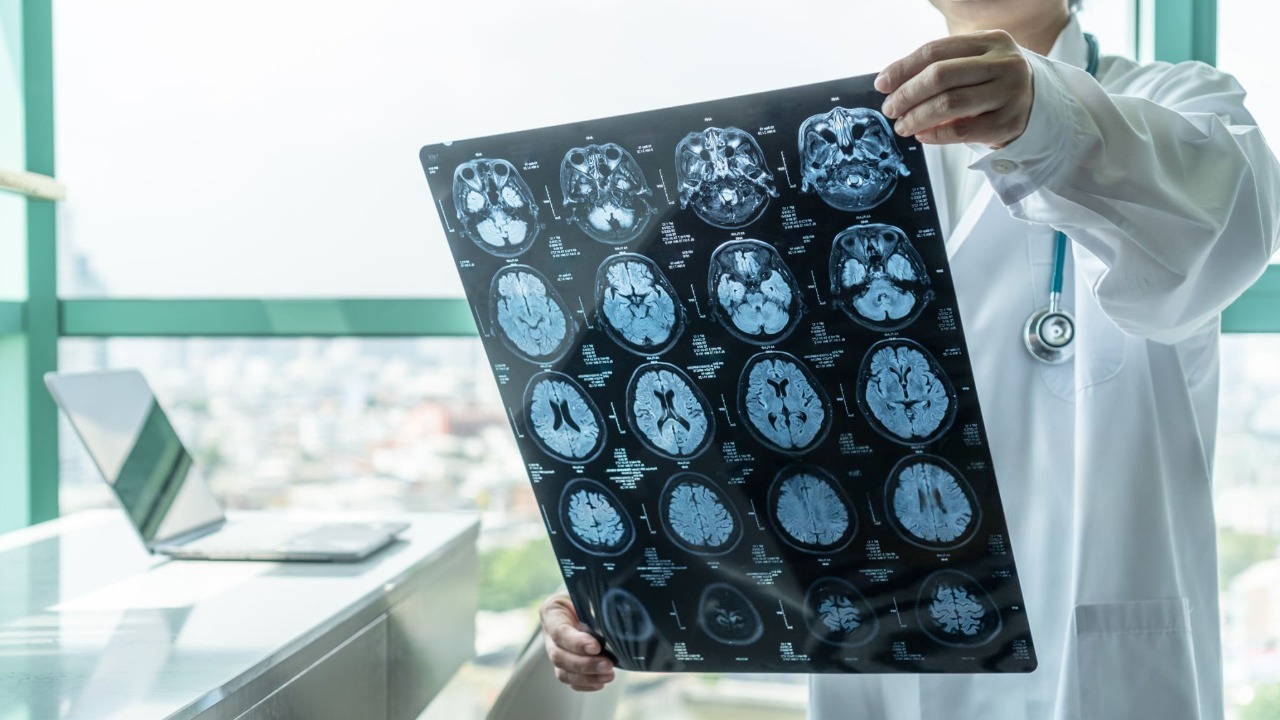 Traumatic Brain Injury