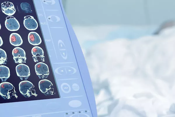 Experienced Catastrophic Injury Lawyesr Delray Beach